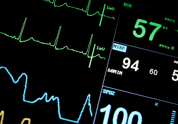 A heartrate monitor